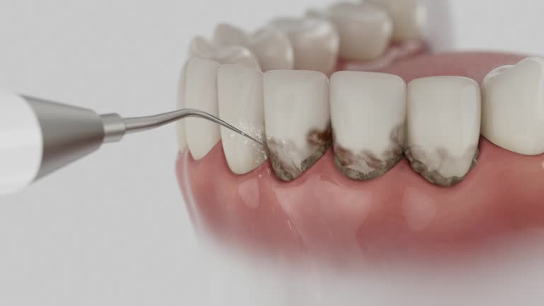 Reliable Dental contractor in Gautier, MS by Smile Center Dentistry